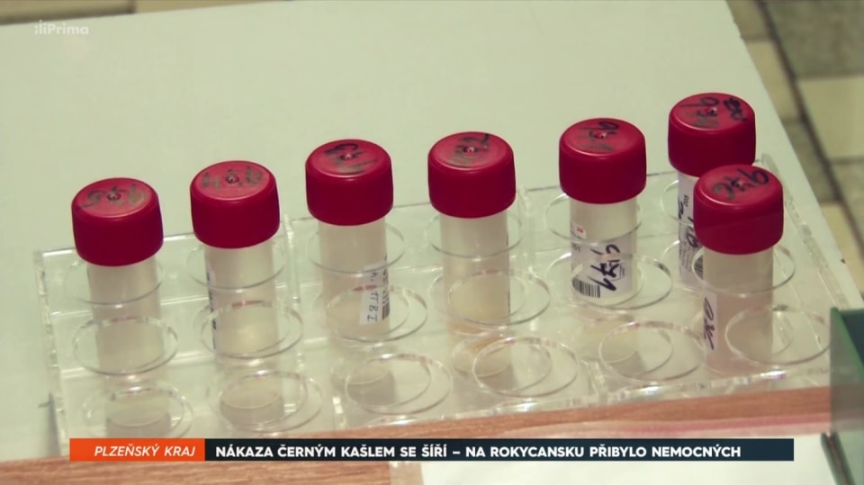 17. 11. 2017 ZPRÁVY: NÁKAZA ČERNÝM KAŠLEM SE ŠÍŘÍ - NA ROKYCANSKU PŘIBYLO NEMOCNÝCH